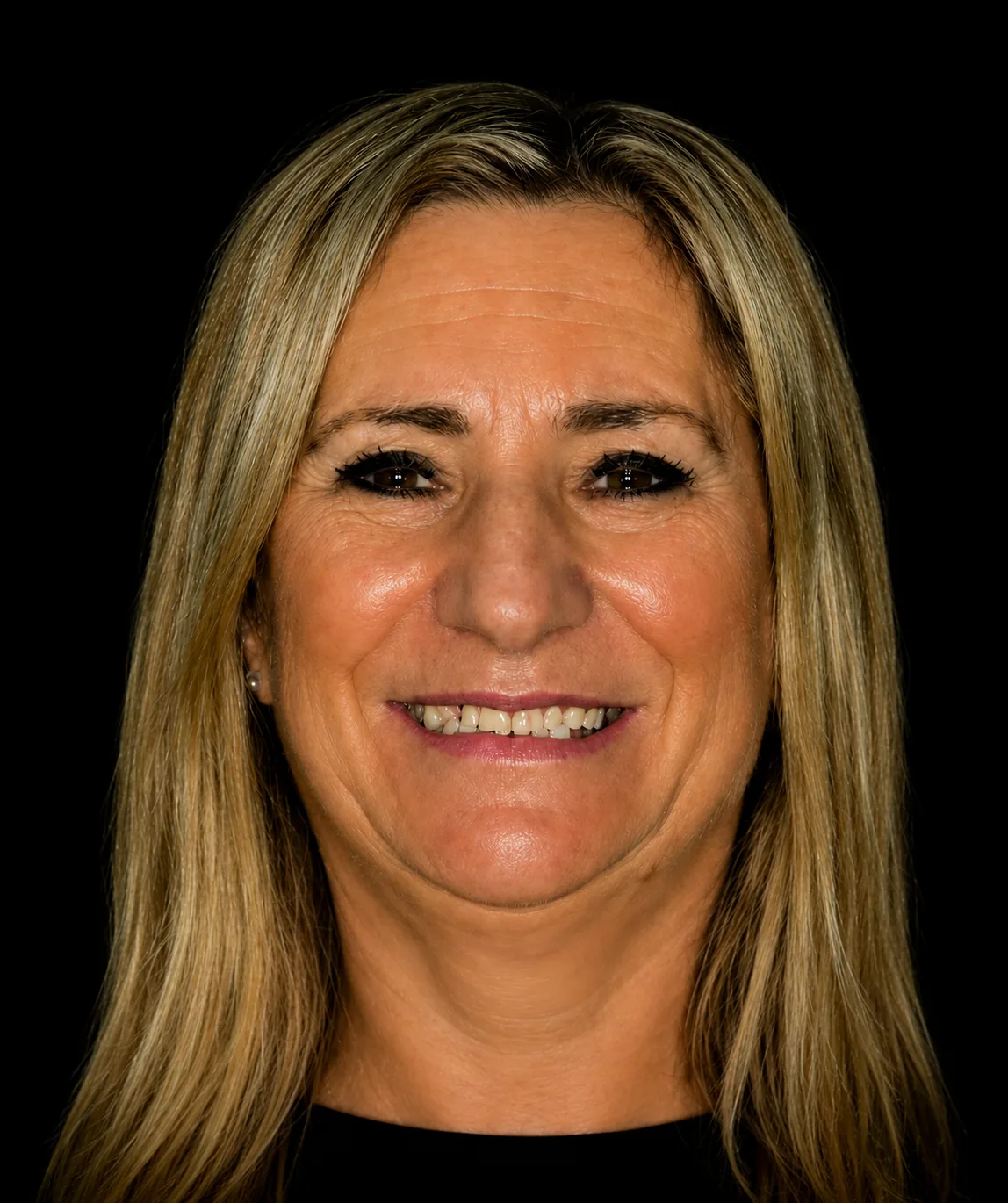 Paciente - IMPLANTES DENTALES